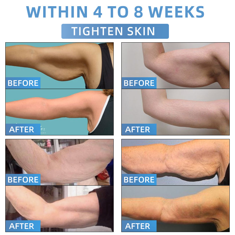 Seurico® Advanced Firming & Wrinkle-Reducing Cream: Restore Skin Elasticity