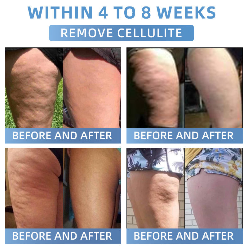 Seurico® Advanced Firming & Wrinkle-Reducing Cream: Restore Skin Elasticity