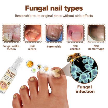 🐝Seurico™ Bee Venom Nail Psoriasis Treatment Spray