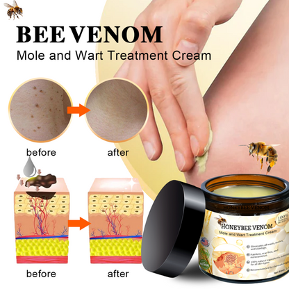 🎄 Holiday Sale Extravaganza: Enjoy 50% Off!  ✨Honeybee Venom Mole and Wart Cream