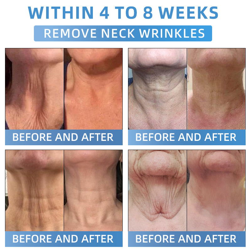 Seurico® Advanced Firming & Wrinkle-Reducing Cream: Restore Skin Elasticity
