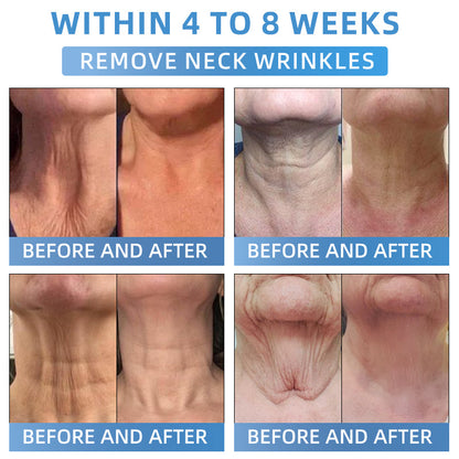 Seurico® Advanced Firming & Wrinkle-Reducing Cream: Restore Skin Elasticity