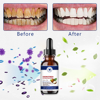 ⚡🔥Limited Time Only: Get 50% Off Now! 🎁 Coconut Fresh Oil-Pulling Mouthwash
