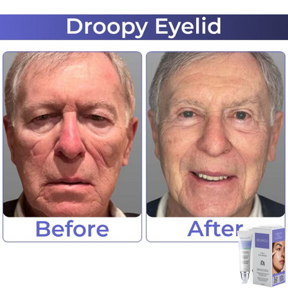 🎄 Holiday Sale Extravaganza: Enjoy 50% Off! 🎁🧚‍♂️Advanced Collagen Complete Eye Cream