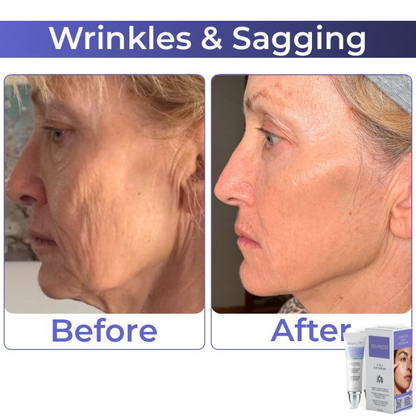 🎄 Holiday Sale Extravaganza: Enjoy 50% Off! 🎁🧚‍♂️Advanced Collagen Complete Eye Cream