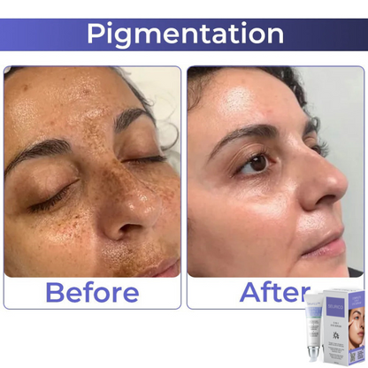 🎄 Holiday Sale Extravaganza: Enjoy 50% Off! 🎁🧚‍♂️Advanced Collagen Complete Eye Cream