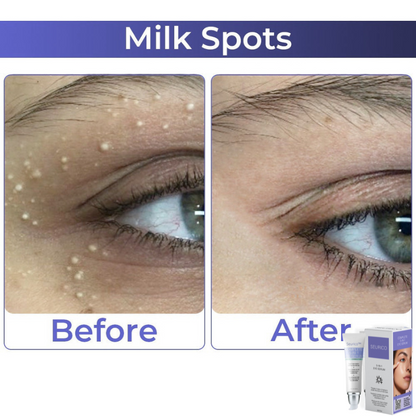 🎄 Holiday Sale Extravaganza: Enjoy 50% Off! 🎁🧚‍♂️Advanced Collagen Complete Eye Cream