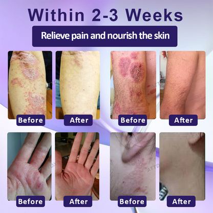 Violet Soothing Skin Therapy Ointment