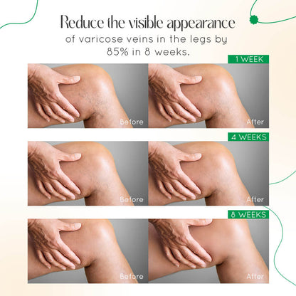 Seurico Vein Therapy Cream