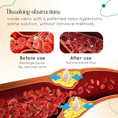 Seurico Vein Therapy Cream